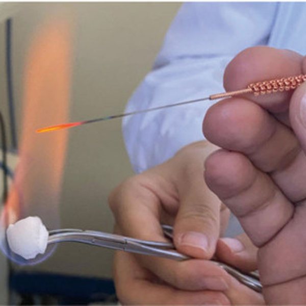 A practitioner heats a fire needle red-hot over an alcohol flame held in forceps