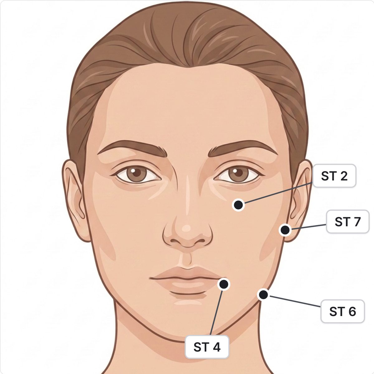 Drawn front view of a face with four points marked on one side: ST 2 below the eye, ST 7 in front of the ear, ST 4 beside the mouth and ST 6 at the angle of the jaw.
