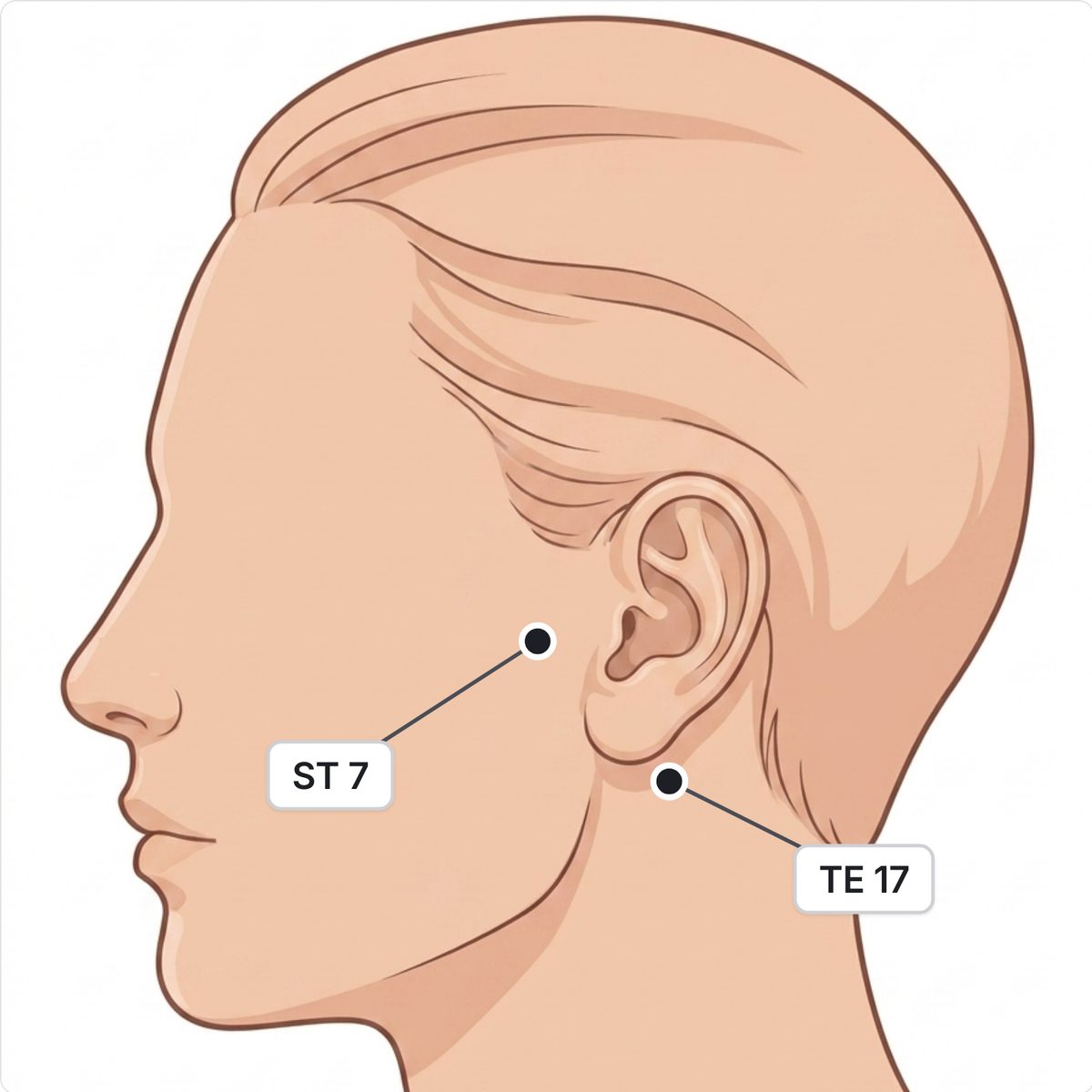 Drawn side profile of a head with two points marked: TE 17 in the hollow behind the earlobe and ST 7 in the notch below the cheekbone in front of the ear.