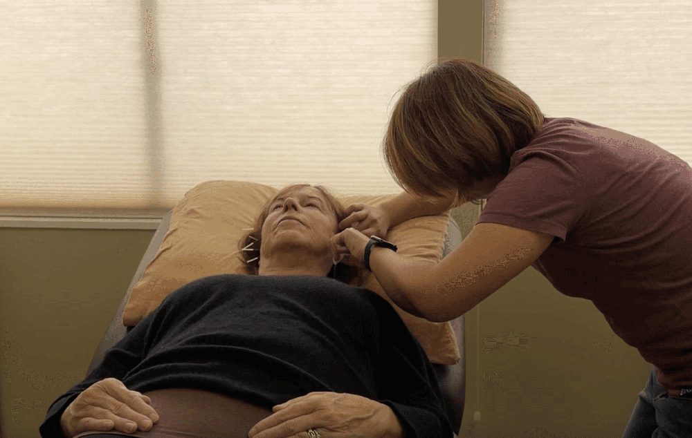 Acupuncturist treating a patient's ear and temple with fine needles while she reclines in a treatment chair