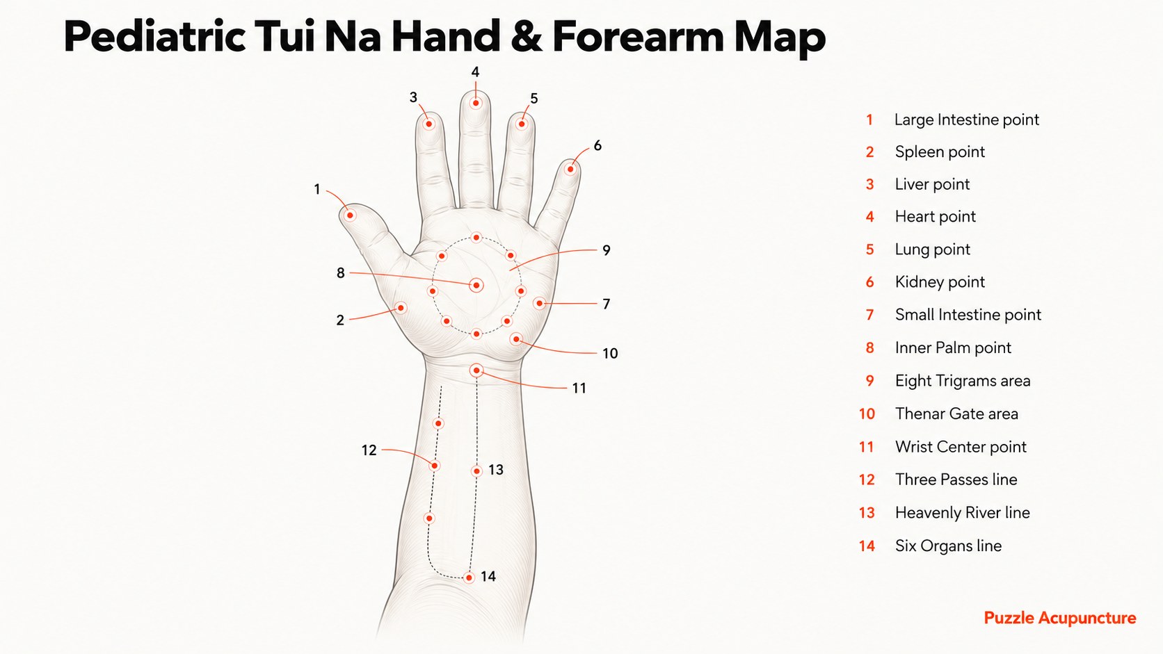 Pediatric tuina hand and forearm map: a child's open hand and forearm with fourteen numbered points and lines. On the fingertips, the Large Intestine, Spleen, Liver, Heart, Lung, Kidney and Small Intestine points. On the palm, the Inner Palm point, the Eight Trigrams area and the Thenar Gate area. At the wrist, the Wrist Center point. On the forearm, the Three Passes line, the Heavenly River line and the Six Organs line.